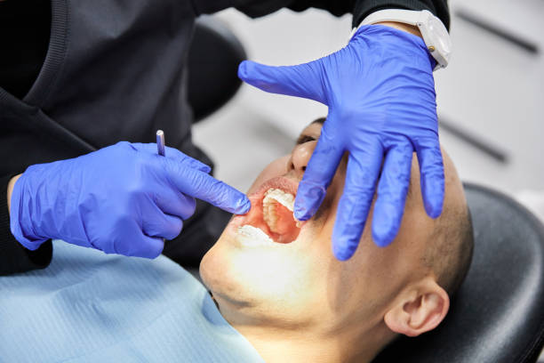 Best Emergency Dentist for Lost Fillings or Crowns in Redington Beach, FL